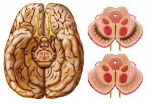 Brain On Drugs - Dopamine